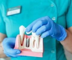 Dental Implants in Coppell