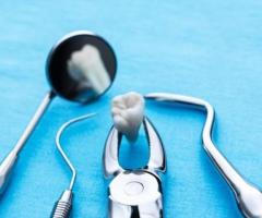 Teeth Extraction in Fort Worth