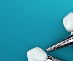 Dental Implants in Beverly Hills